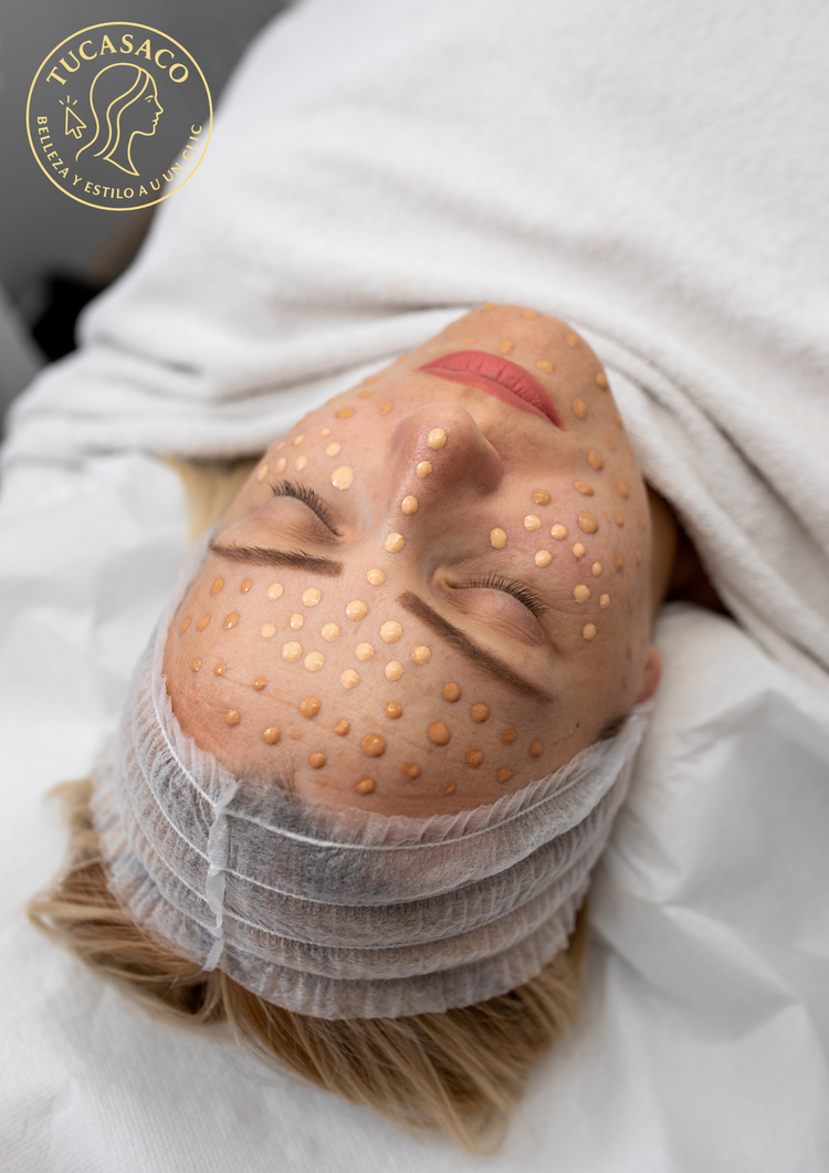 Tratamientos Especiales